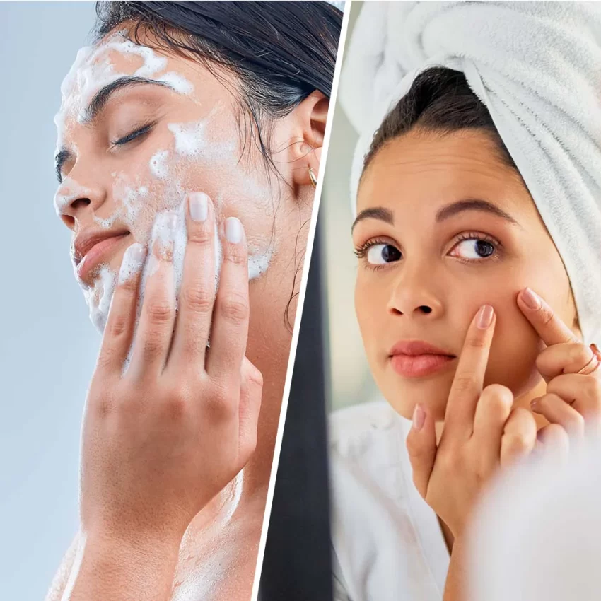 12 Best Face Washes for Dry Skin in Winter Session