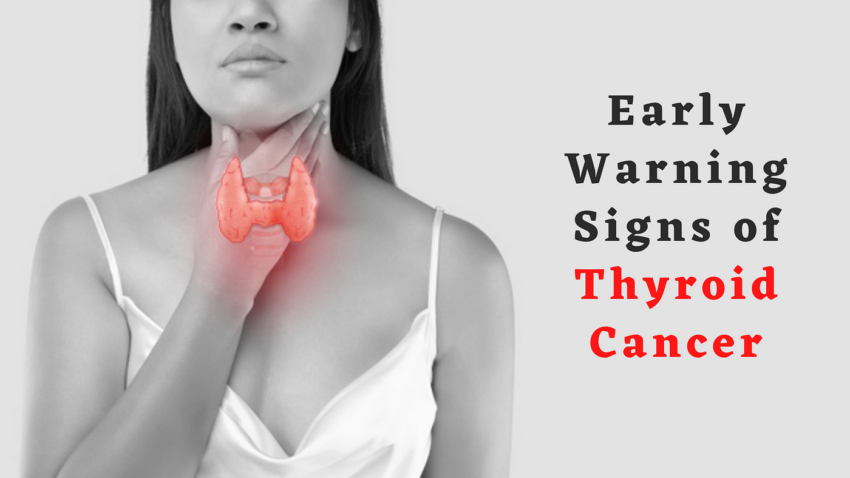How To Recognise The Early Signs Of Thyroid Cancer